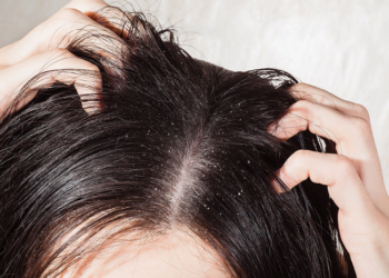 Recipe against dandruff and hair loss.